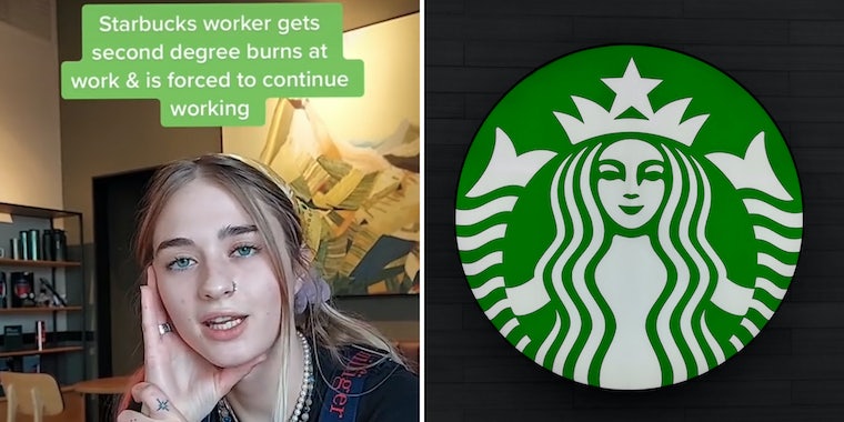 «Мне пришлось сразу же вернуться на работу»: работница Starbucks говорит, что ей пришлось продолжить работу после того, как она получила ожоги 2-й степени на работе 